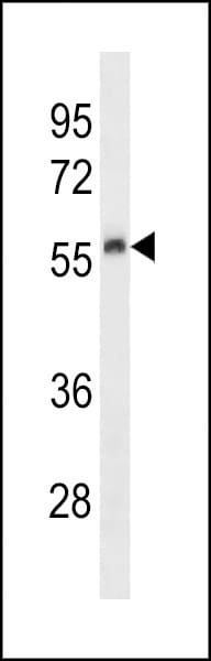 Urokinase Antibody in Western Blot (WB)