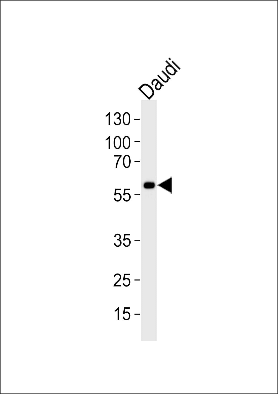 CHRNA9 Antibody in Western Blot (WB)