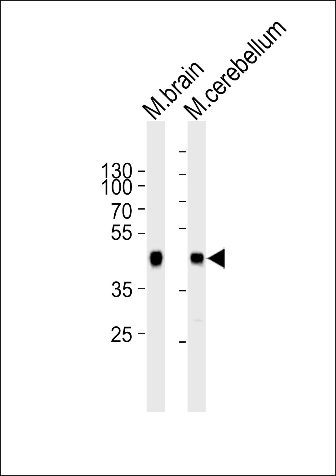 ZDHHC14 Antibody in Western Blot (WB)