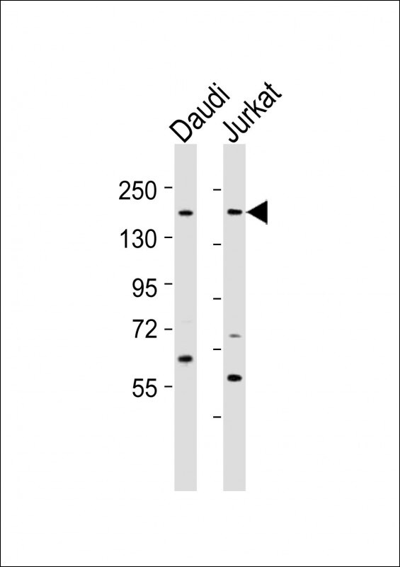 BZRAP1 Antibody in Western Blot (WB)