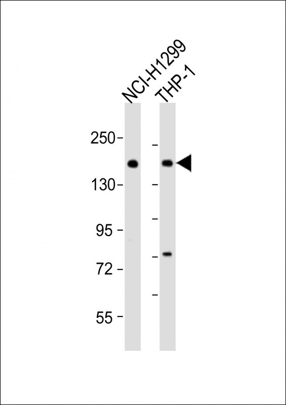 CaV2.1 Antibody in Western Blot (WB)
