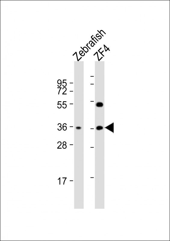 CLVS2 Antibody in Western Blot (WB)