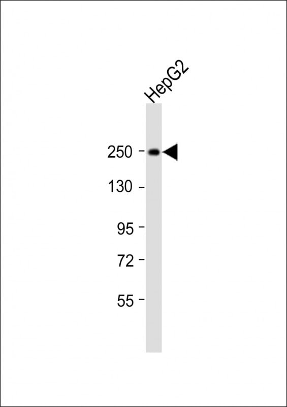 MYO5B Antibody in Western Blot (WB)