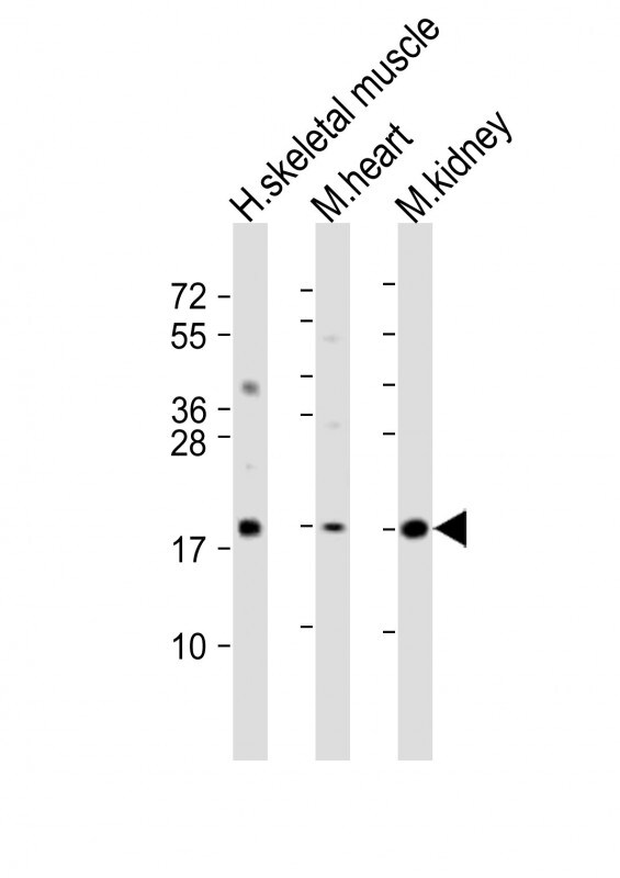 SDHC Antibody in Western Blot (WB)