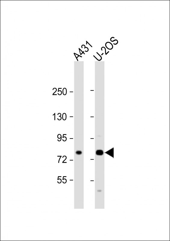 MAN1A2 Antibody in Western Blot (WB)