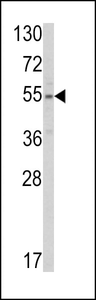 SLC38A3 Antibody in Western Blot (WB)