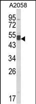 AGPAT3 Antibody in Western Blot (WB)