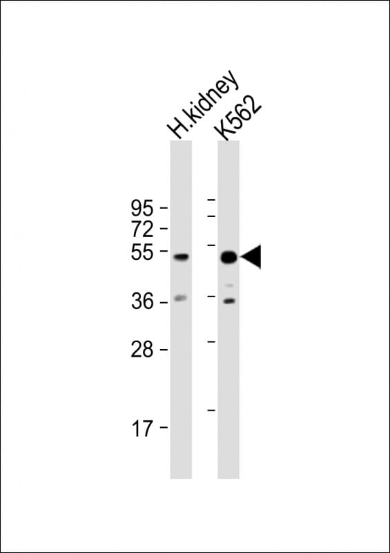 ALDH3B1 Antibody in Western Blot (WB)