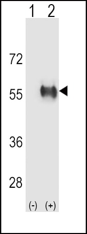 ALDH3B1 Antibody in Western Blot (WB)