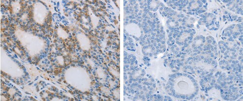 NCK2 Antibody in Immunohistochemistry (Paraffin) (IHC (P))