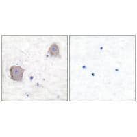 mGluR4 Antibody in Immunohistochemistry (Paraffin) (IHC (P))