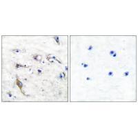 JM4 Antibody in Immunohistochemistry (Paraffin) (IHC (P))