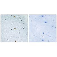 ZFHX3 Antibody in Immunohistochemistry (Paraffin) (IHC (P))