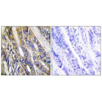 DGKH Antibody in Immunohistochemistry (Paraffin) (IHC (P))