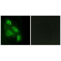 EPS8L3 Antibody in Immunocytochemistry (ICC/IF)