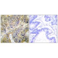 EPS8L3 Antibody in Immunohistochemistry (Paraffin) (IHC (P))