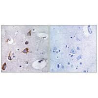 CHSY1 Antibody in Immunohistochemistry (Paraffin) (IHC (P))