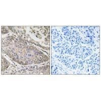 PLA2G4E Antibody in Immunohistochemistry (Paraffin) (IHC (P))