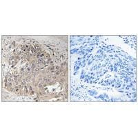 Spectrin beta-5 Antibody in Immunohistochemistry (Paraffin) (IHC (P))