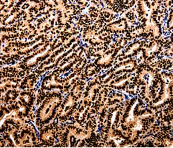 APIP Antibody in Immunohistochemistry (Paraffin) (IHC (P))