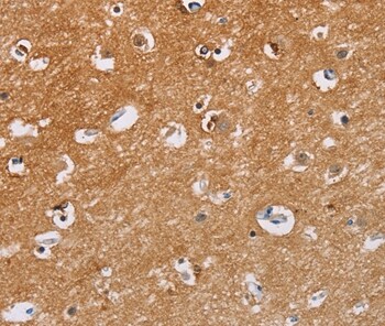 Calpain 7 Antibody in Immunohistochemistry (Paraffin) (IHC (P))