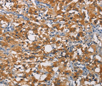 CRTAM Antibody in Immunohistochemistry (Paraffin) (IHC (P))