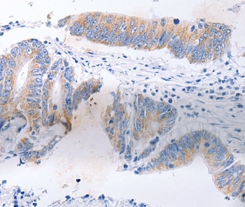 SERP1 Antibody in Immunohistochemistry (Paraffin) (IHC (P))