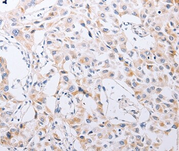 SERP1 Antibody in Immunohistochemistry (Paraffin) (IHC (P))