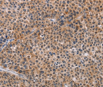 AGPS Antibody in Immunohistochemistry (Paraffin) (IHC (P))