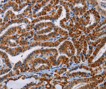 AGPS Antibody in Immunohistochemistry (Paraffin) (IHC (P))