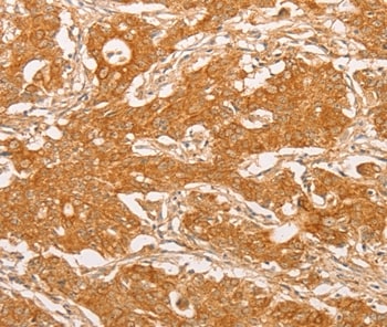 YARS2 Antibody in Immunohistochemistry (Paraffin) (IHC (P))