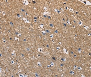 GSTA2 Antibody in Immunohistochemistry (Paraffin) (IHC (P))