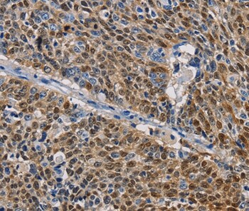 GSTA2 Antibody in Immunohistochemistry (Paraffin) (IHC (P))