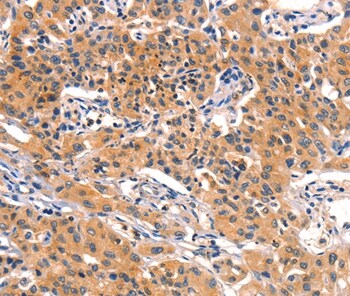 Pancreatic Amylase Antibody in Immunohistochemistry (Paraffin) (IHC (P))