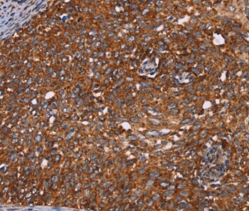 CYP2W1 Antibody in Immunohistochemistry (Paraffin) (IHC (P))