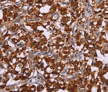 CYP2W1 Antibody in Immunohistochemistry (Paraffin) (IHC (P))