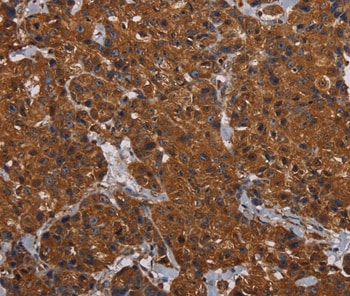 HYAL2 Antibody in Immunohistochemistry (Paraffin) (IHC (P))