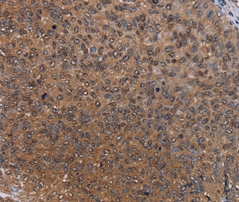 HYAL2 Antibody in Immunohistochemistry (Paraffin) (IHC (P))