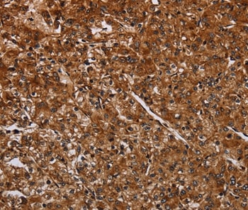 ACP6 Antibody in Immunohistochemistry (Paraffin) (IHC (P))