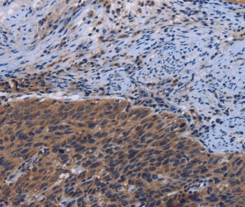 LRRC15 Antibody in Immunohistochemistry (Paraffin) (IHC (P))