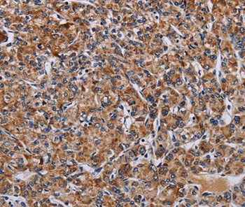 LRRC15 Antibody in Immunohistochemistry (Paraffin) (IHC (P))