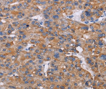 NIT1 Antibody in Immunohistochemistry (Paraffin) (IHC (P))