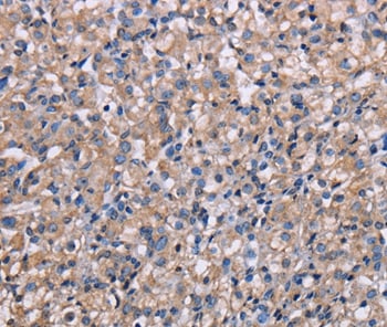 NIT1 Antibody in Immunohistochemistry (Paraffin) (IHC (P))