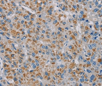 PNLIP Antibody in Immunohistochemistry (Paraffin) (IHC (P))