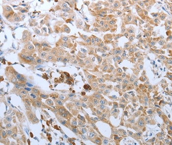 FGF1 Antibody in Immunohistochemistry (Paraffin) (IHC (P))