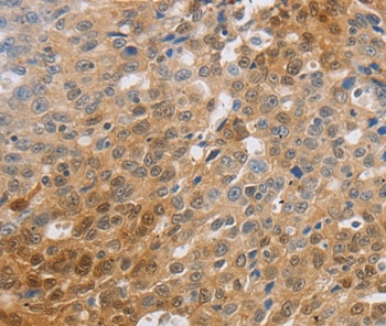 MCT2 Antibody in Immunohistochemistry (Paraffin) (IHC (P))