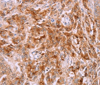 LPCAT4 Antibody in Immunohistochemistry (Paraffin) (IHC (P))