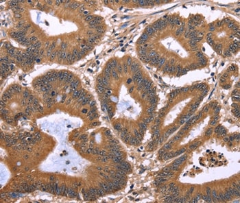 EAP2 Antibody in Immunohistochemistry (Paraffin) (IHC (P))