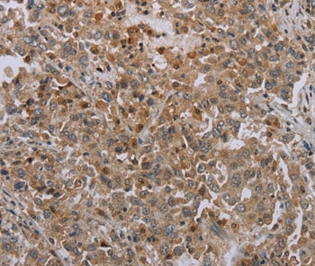 Mig-6 Antibody in Immunohistochemistry (Paraffin) (IHC (P))