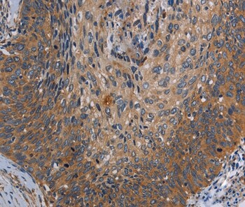 PARP10 Antibody in Immunohistochemistry (Paraffin) (IHC (P))